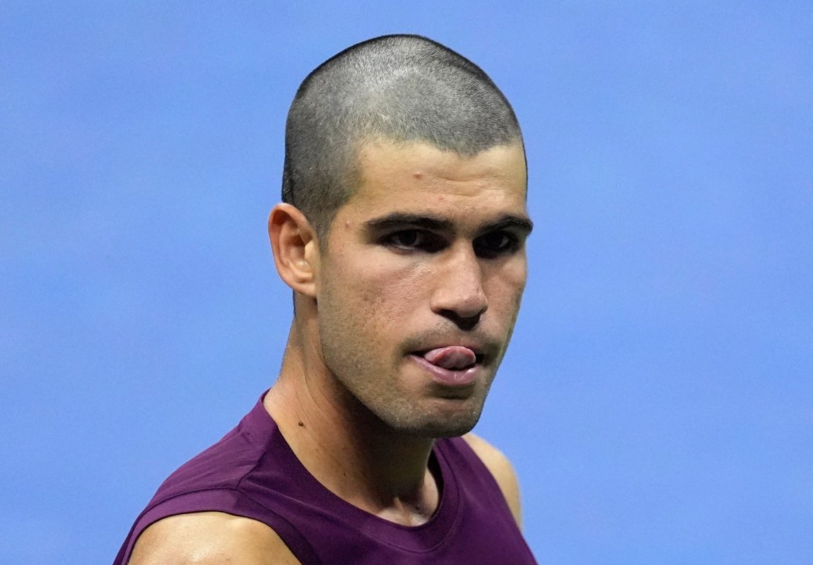 Especial: Información Exclusiva: Alcaraz Sobre Su Corte De Pelo: “Mi Hermano Se Equivocó Con La Máquina... Y La Única Manera De Arreglarlo Es Raparlo”