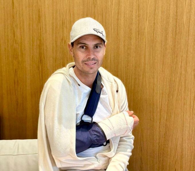 Rafa Nadal, operado de la mano derecha por una artrosis severa