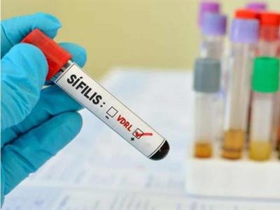 Actualidad: Aumento De Casos De Sífilis En Uruguay Alerta A Las Autoridades