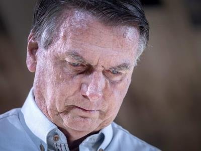 Jair Bolsonaro Sufrió "Lesiones Leves" Por Caída En Prisión